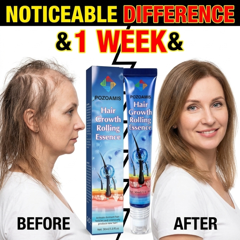 Hair Care Serum - Handy Roller‑Ball Scalp Nourishment Hair Serum