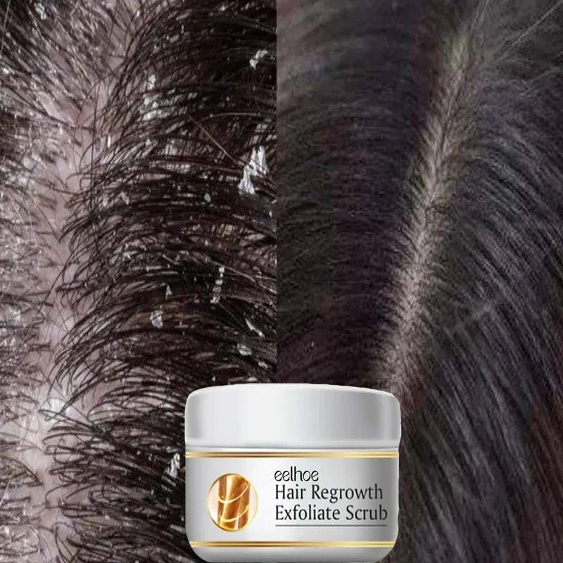 Fast Anti Dandruff Hair Treatm - Scalp Scrub Exfoliant ulasan dan harga