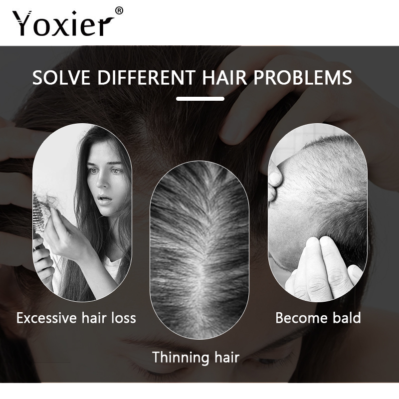 Intensive Growth Serum Prevent - Hair Care Serum ulasan dan harga