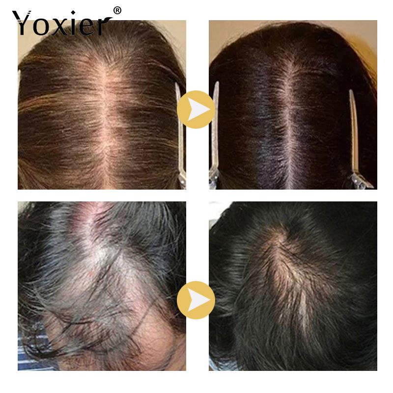 Intensive Growth Serum Prevent - Hair Care Serum ulasan dan harga